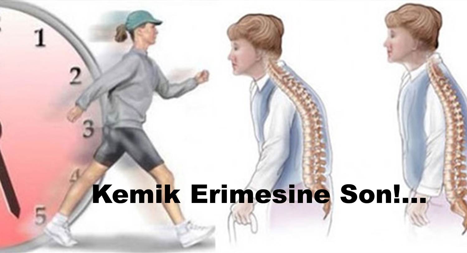 Spor kemik erimesini engelliyor mu?